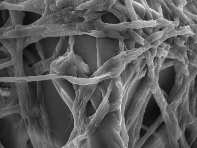 Fusarium mycelia colonise a plastic particle, eElectron microscope image. | Image: Sabreen Samuel Ibrahim Dawoud Fusarium mycelia colonise a plastic particle, eElectron microscope image. | Image: Sabreen Samuel Ibrahim Dawoud