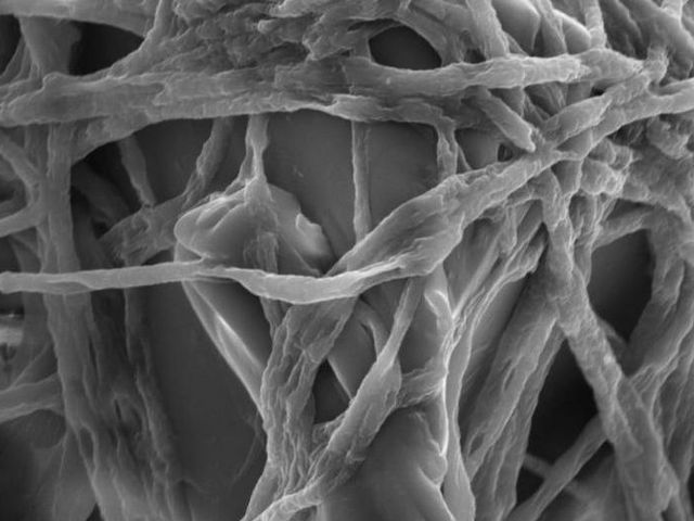 Pilzmyzelien von Fusarium besiedeln einen Kunststoffpartikel, elektronenmikroskopische Aufnahme. | Bild: Sabreen Samuel Ibrahim Dawoud Pilzmyzelien von Fusarium besiedeln einen Kunststoffpartikel, elektronenmikroskopische Aufnahme. | Bild: Sabreen Samuel Ibrahim Dawoud